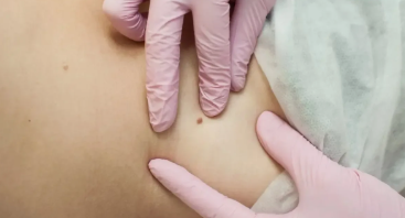 Jak Środowisko Wolne od Zanieczyszczeń Wspiera Twoją Skórę